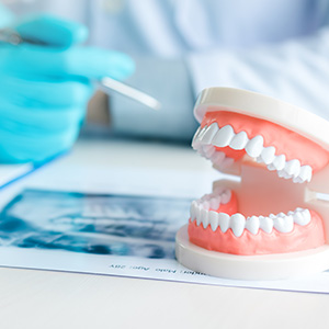 A dental model with open mouth, placed on a table, with a person wearing blue gloves and a white lab coat examining it.
